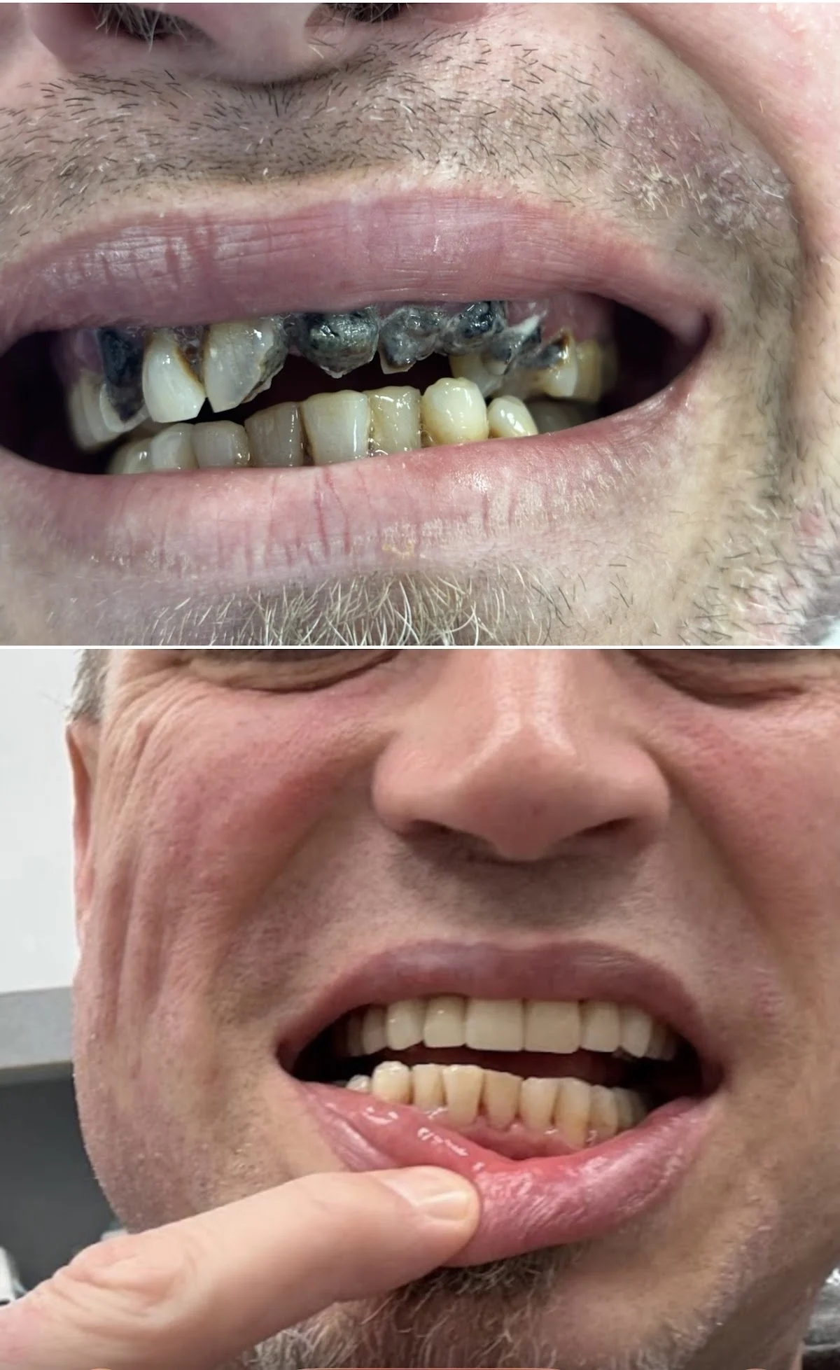 Advanced Dental Care Lakewood - 2
