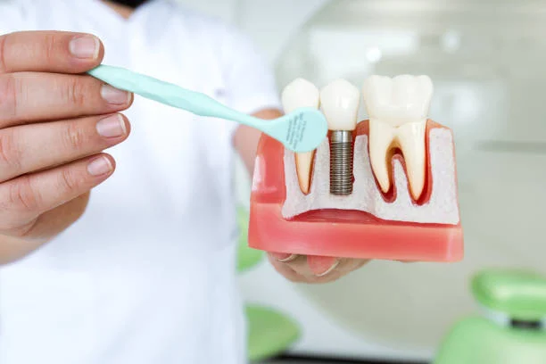 Agave Dental Care West - Implant Dentist - 3