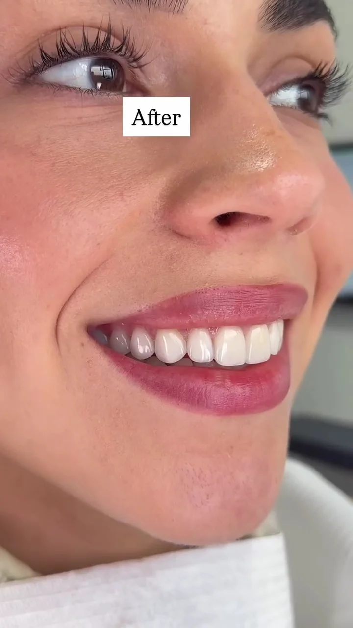 Asaro Dental Aesthetics - 3