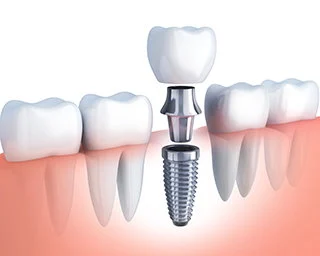 Bagoff Dental Arts - General Family Dentist & Dental Implant Specialist