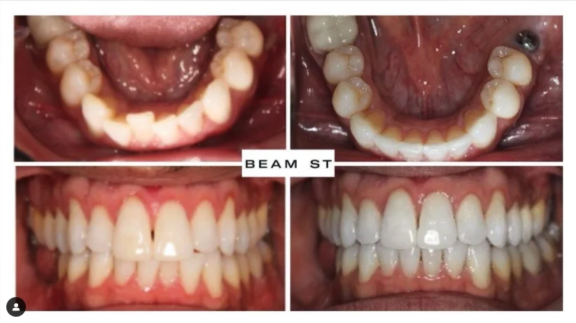 Beam Dental Union Square