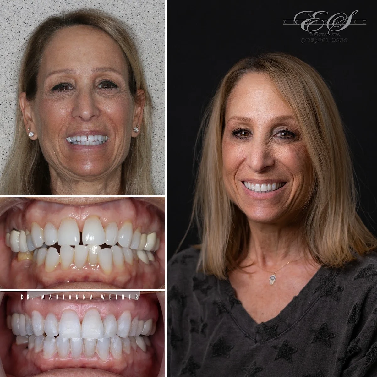 Brooklyn Invisalign Center - 3