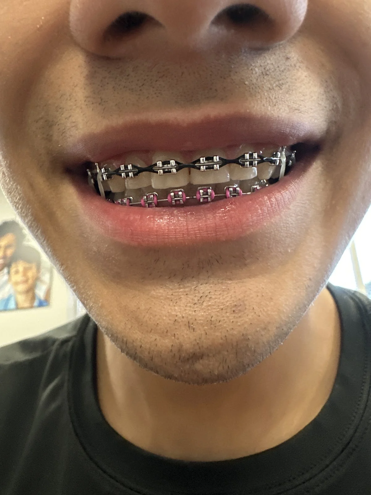 Celebrate Dental & Braces - San Antonio Marbach - 2