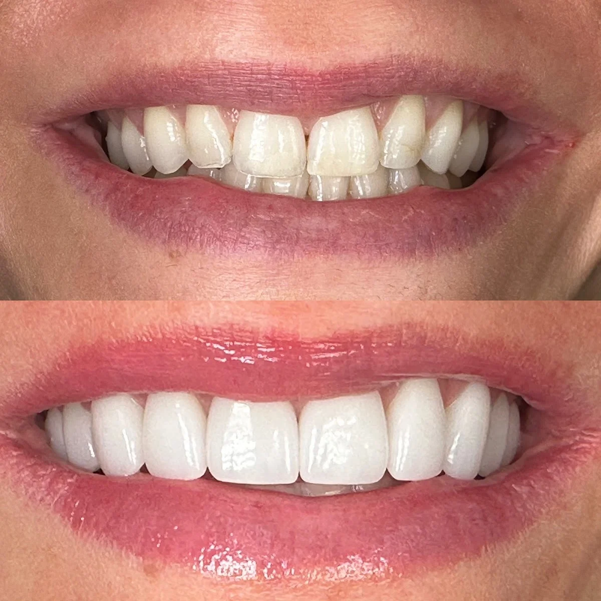 Centerport Cosmetic & Implant Dentistry