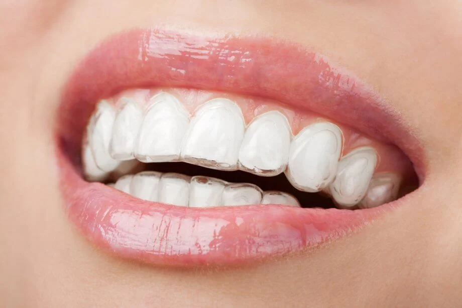 Century Orthodontics Clayton Location