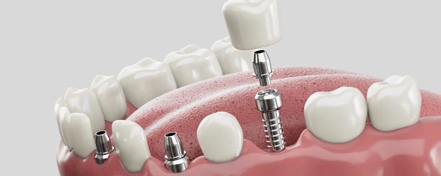 Century Smile Maker - 2