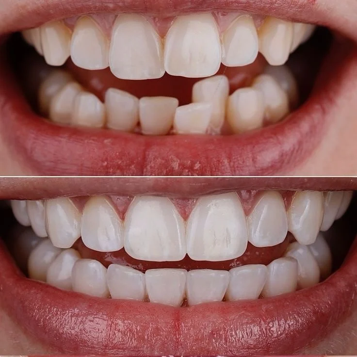 Century Smile Maker - 3