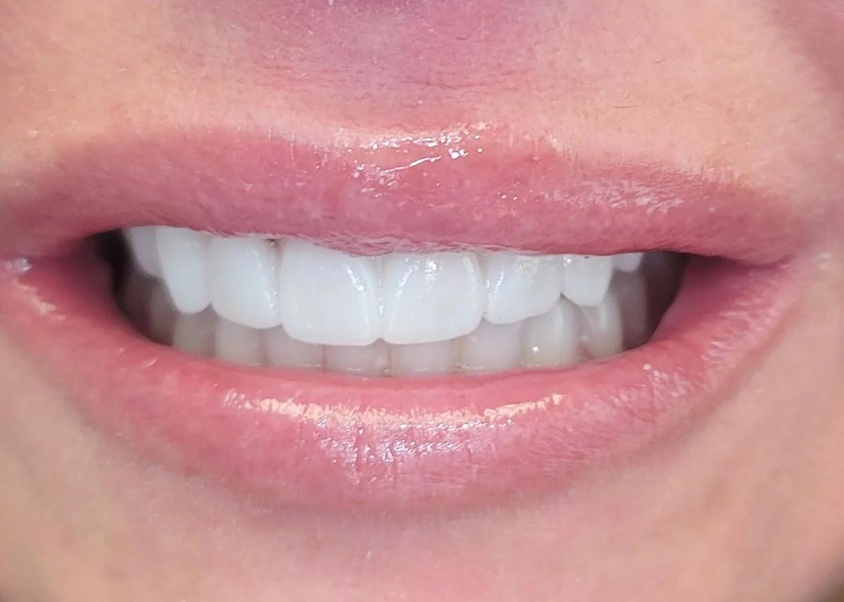 CLE Smiles by Dr. Niki: Nicole Cochran, DDS - 2