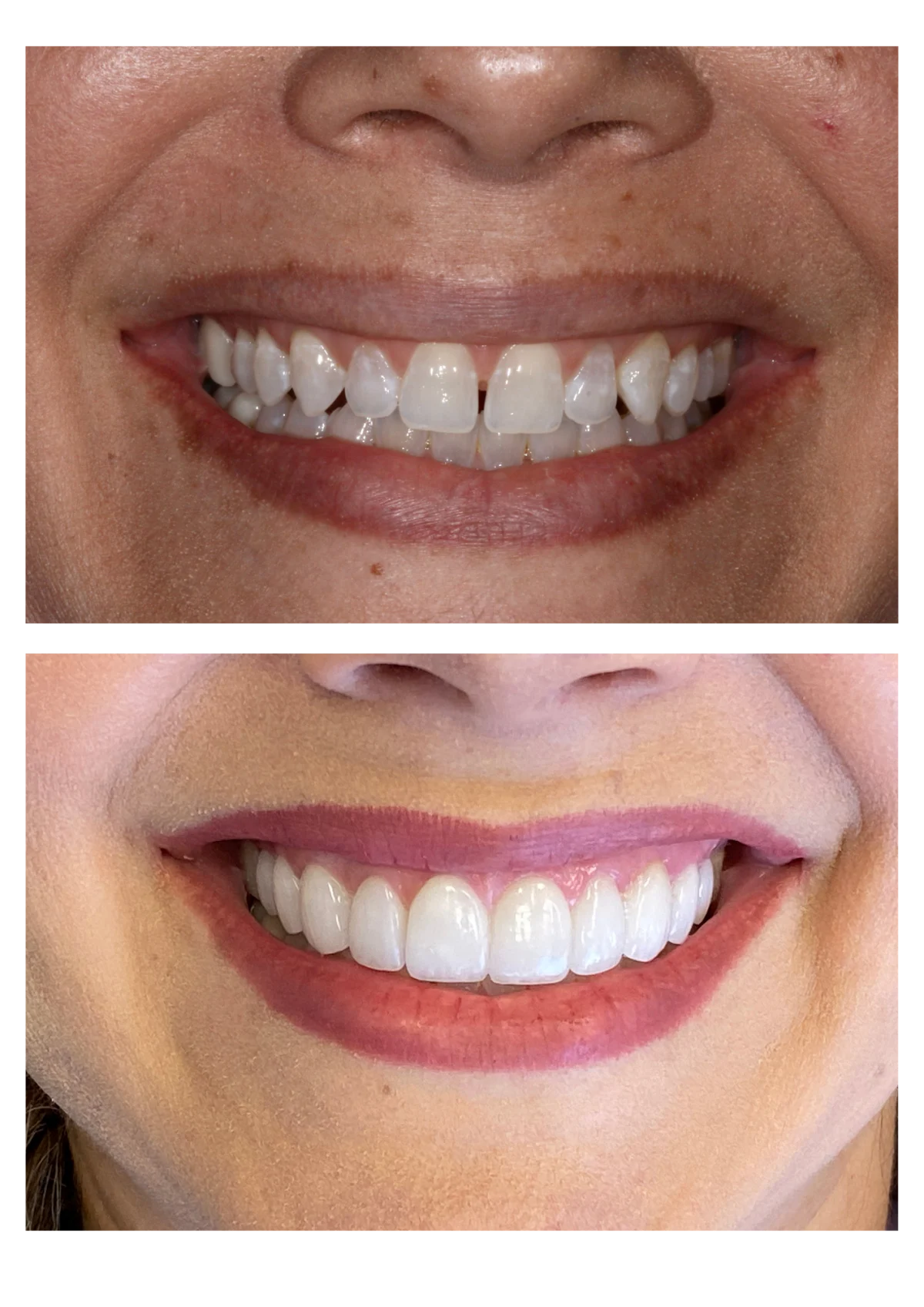 Cosmetic Dentist Honolulu : Wynn H. Okuda DMD Inc