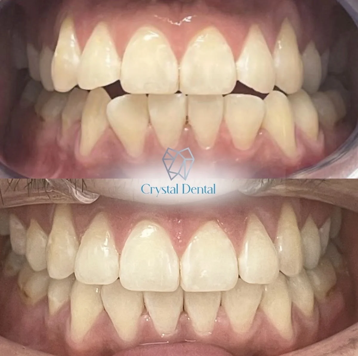 Crystal Dental - 2