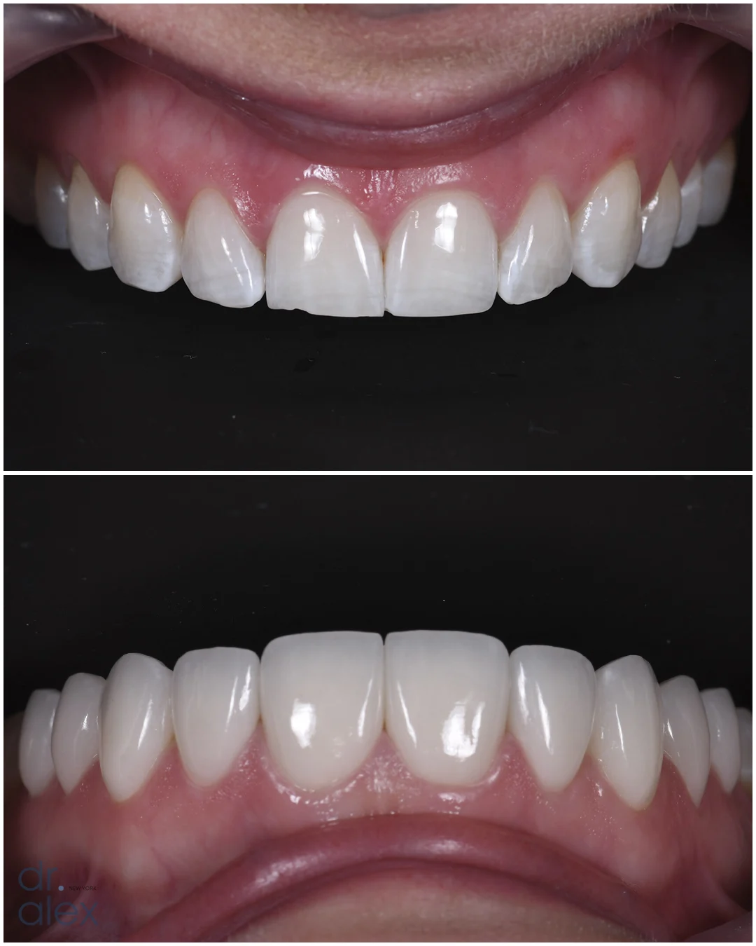 Dr. Alex Rubinov - NYC Cosmetic Dentist - 2