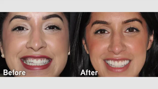 Dr. Alex Rubinov - NYC Cosmetic Dentist - 4