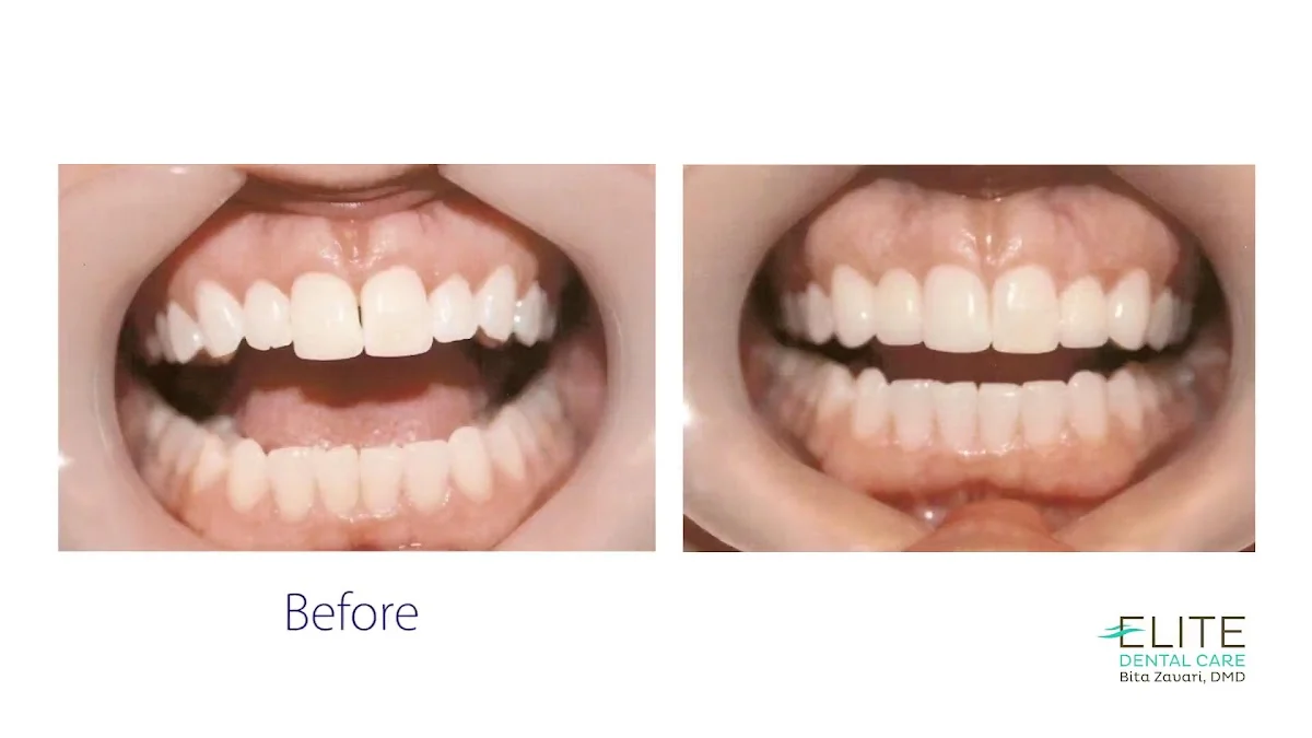 Elite Dental Care: Bita Zavari DMD - 2