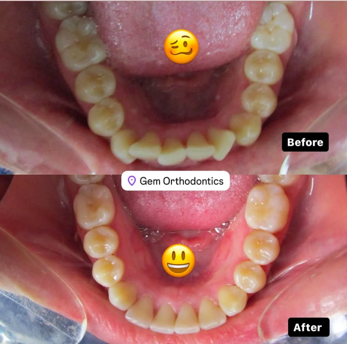 Gem orthodontics LA - 2