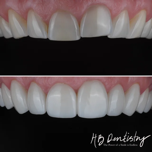 Hinrichs & Buckley Dentistry - Dr. Mark Hinrichs & Dr. Kelsey Buckley - 2