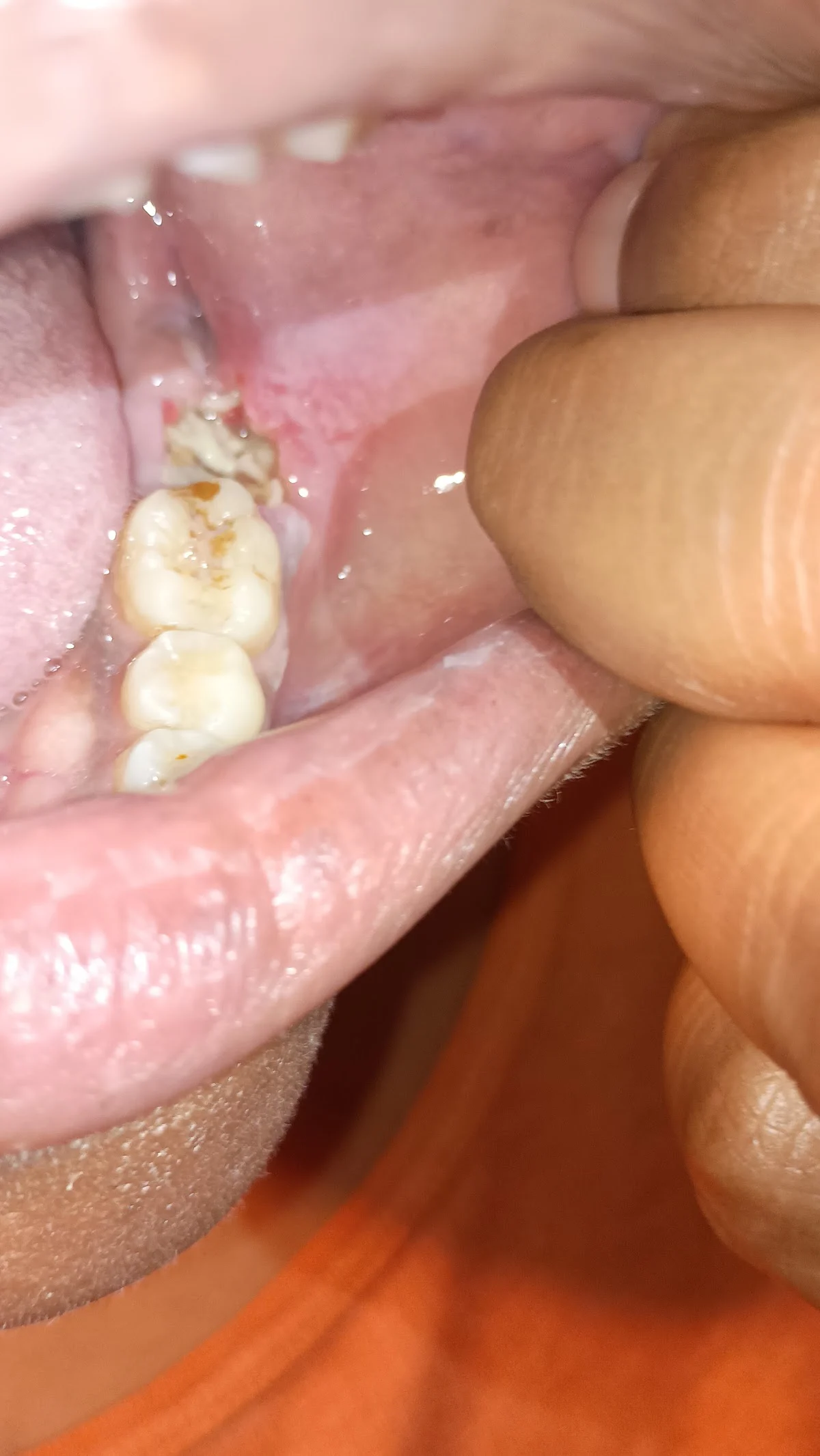 Hudec Dental - 2