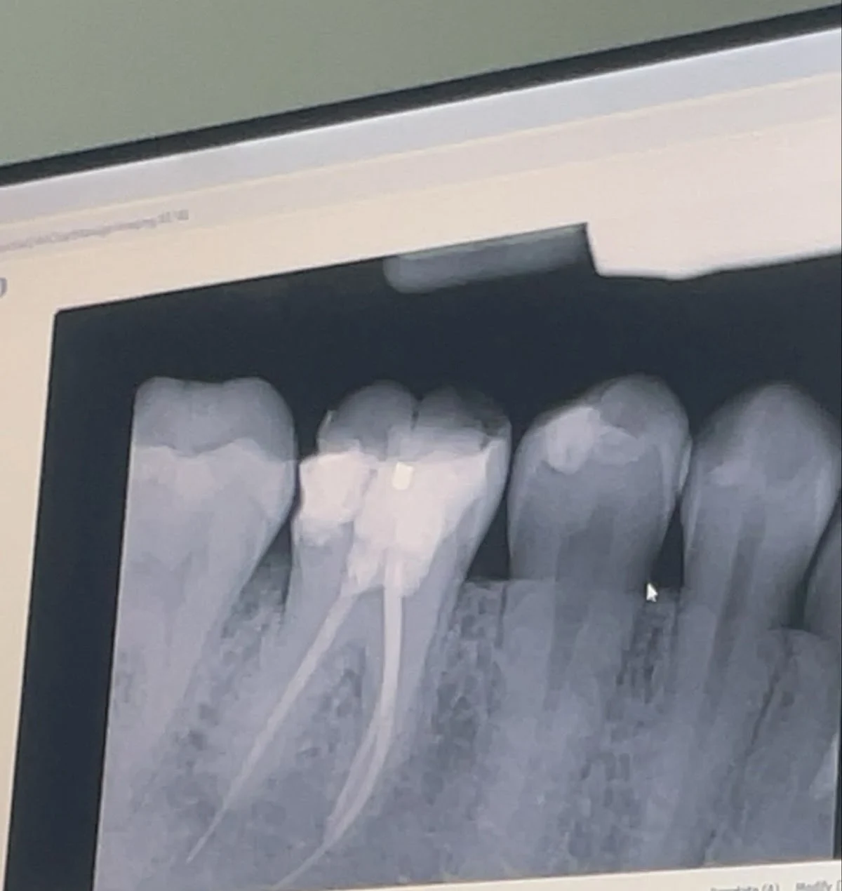 Leestown Dental Care