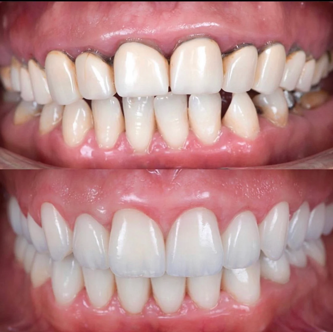 Monterey Hills Dental - 2