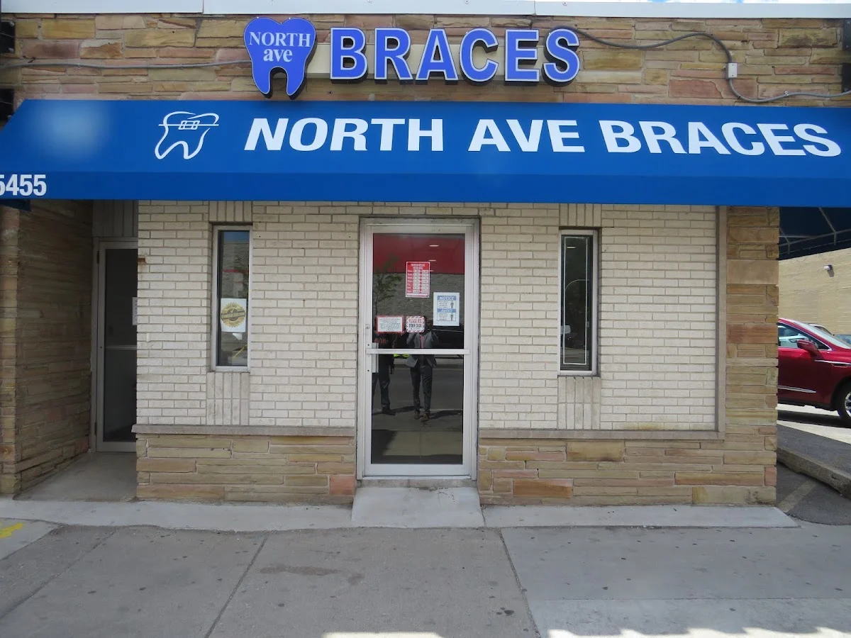 North Ave Braces - 2