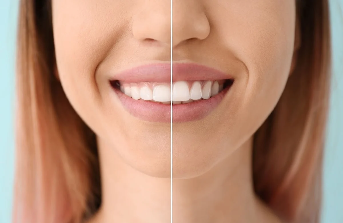 Pinnacle Dentistry - 3
