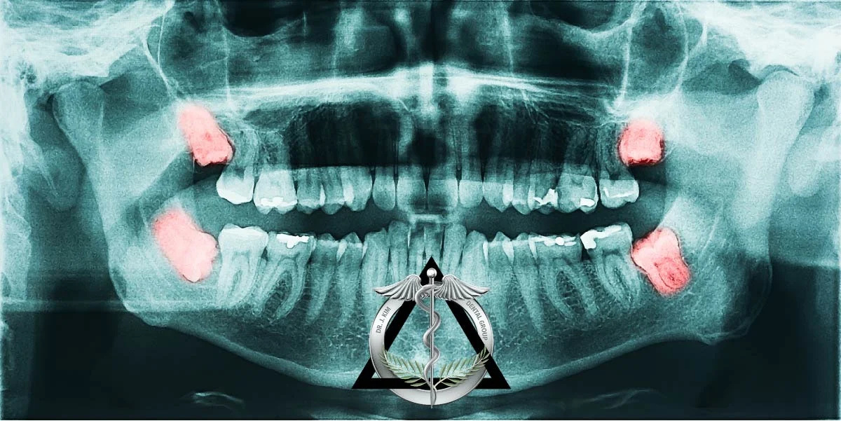 San Jose Dentists Specialists Centers - 2