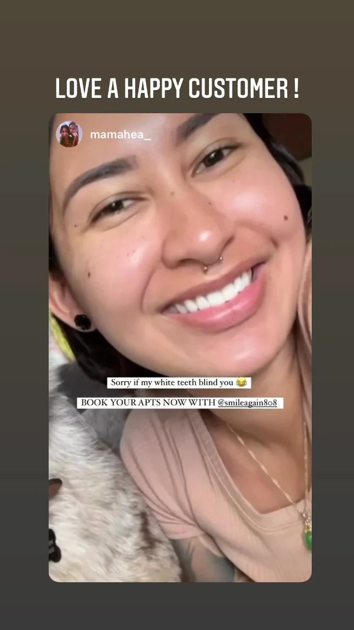 Smile Again Teeth Whitening - 3