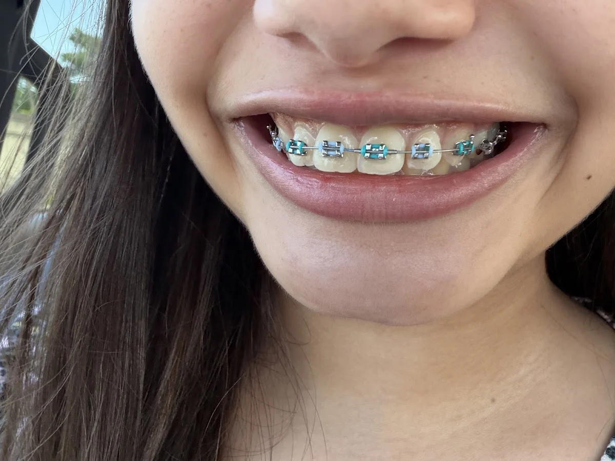 Smile Doctors by DN Ortho - Metairie - 2
