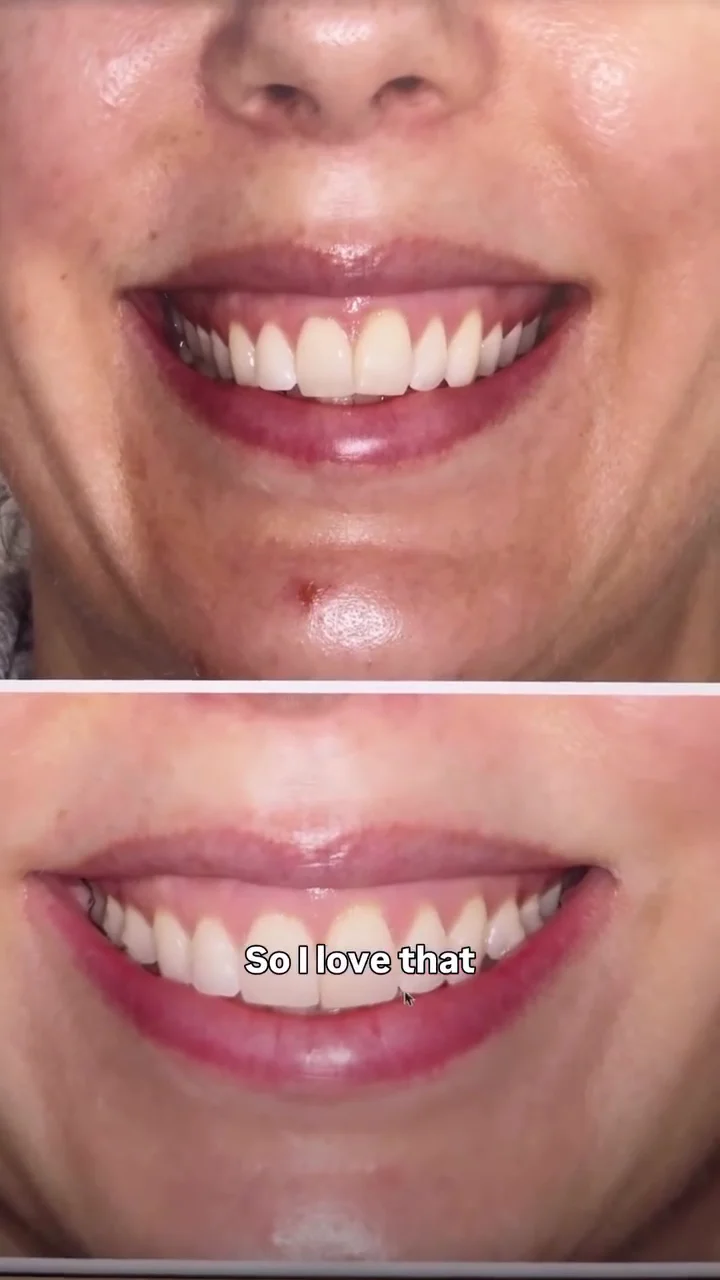 Smile Pop - Dr. Courtney Barry Orthodontist - 3