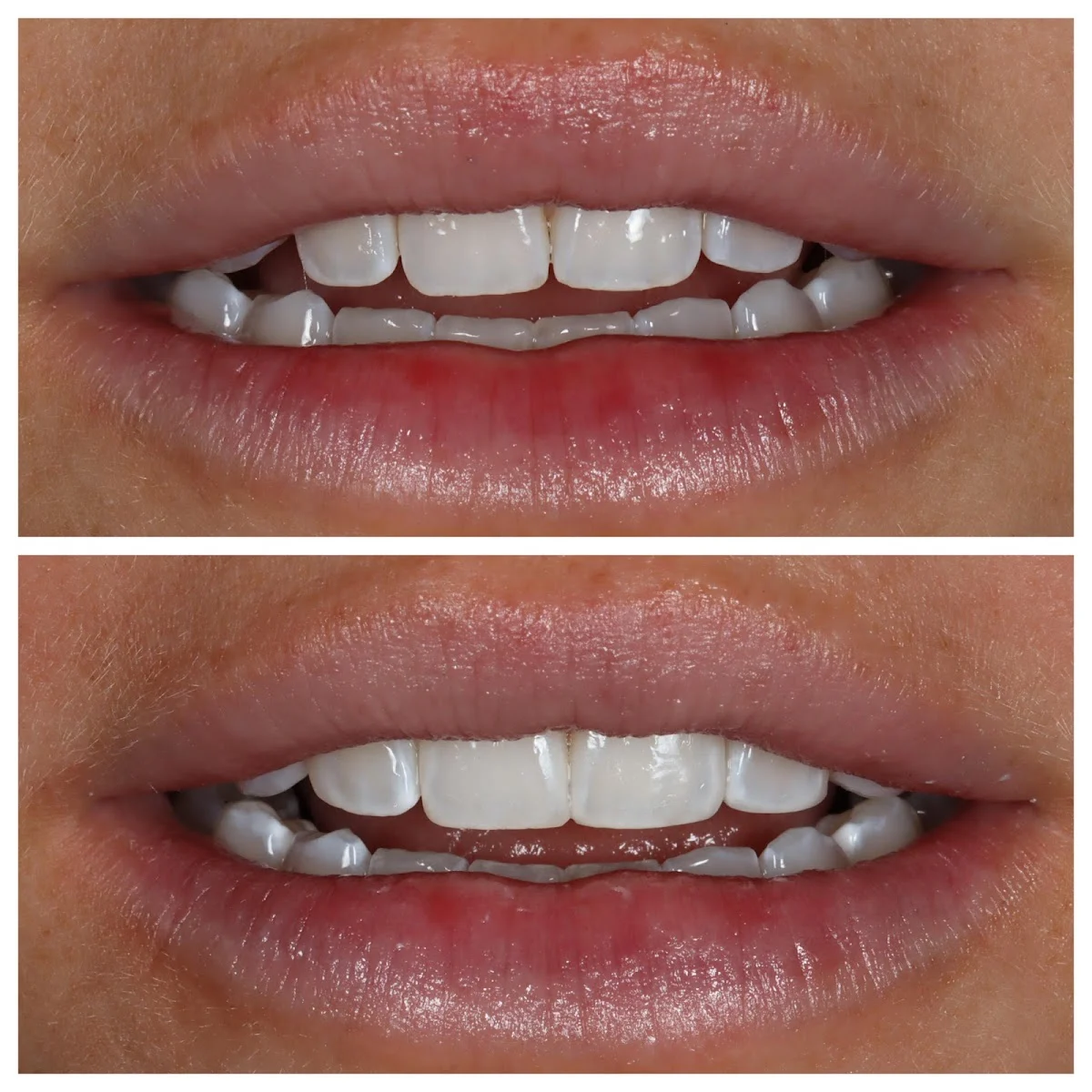 The New York Center for Cosmetic Dentistry - 3