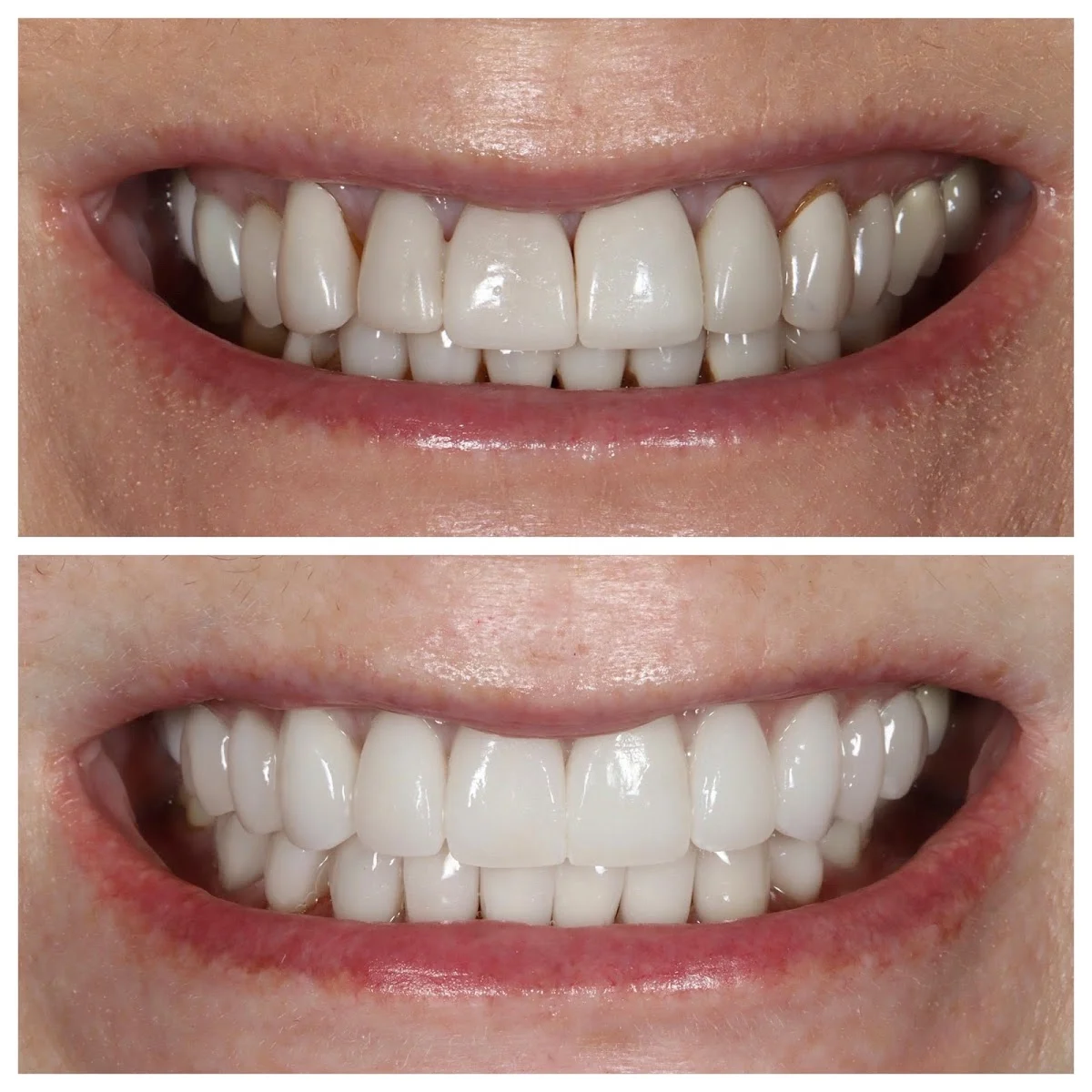 The New York Center for Cosmetic Dentistry