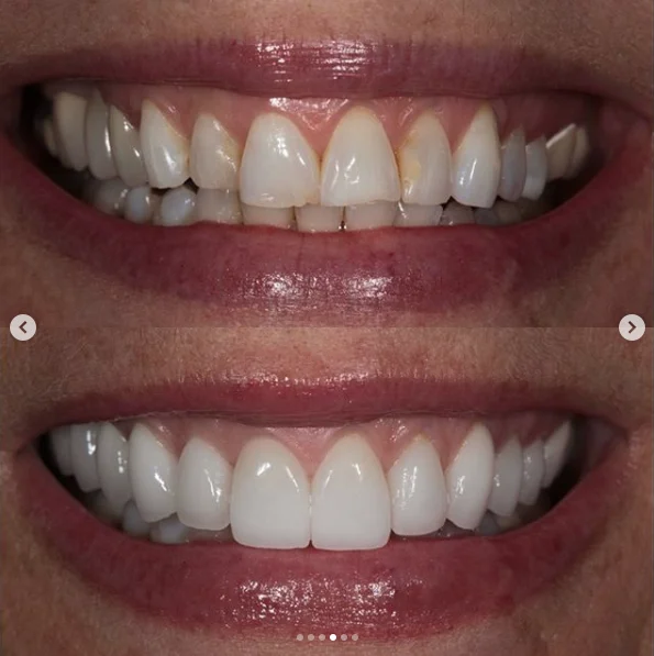 The Smile Code