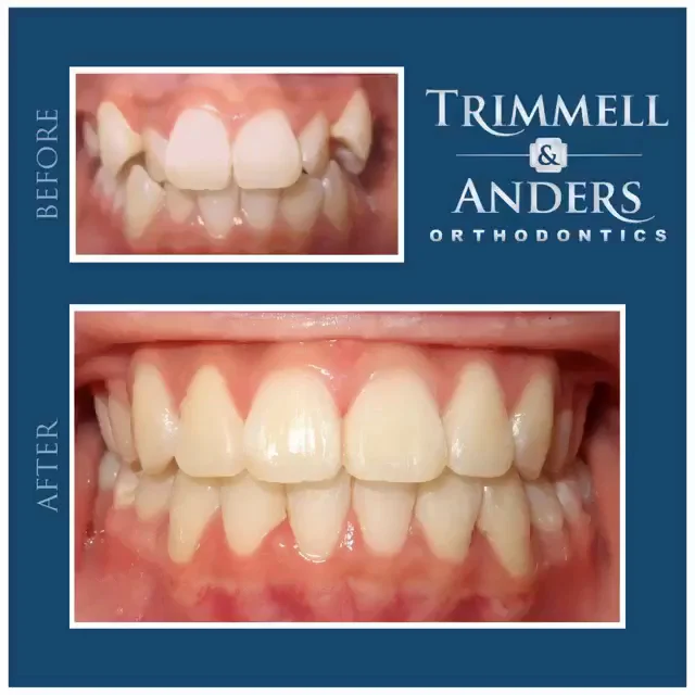Trimmell Anders & White Orthodontics - 2