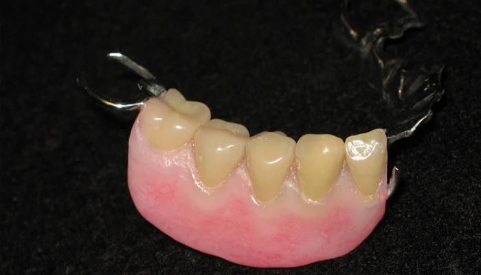 Washington State Prosthodontics - 2