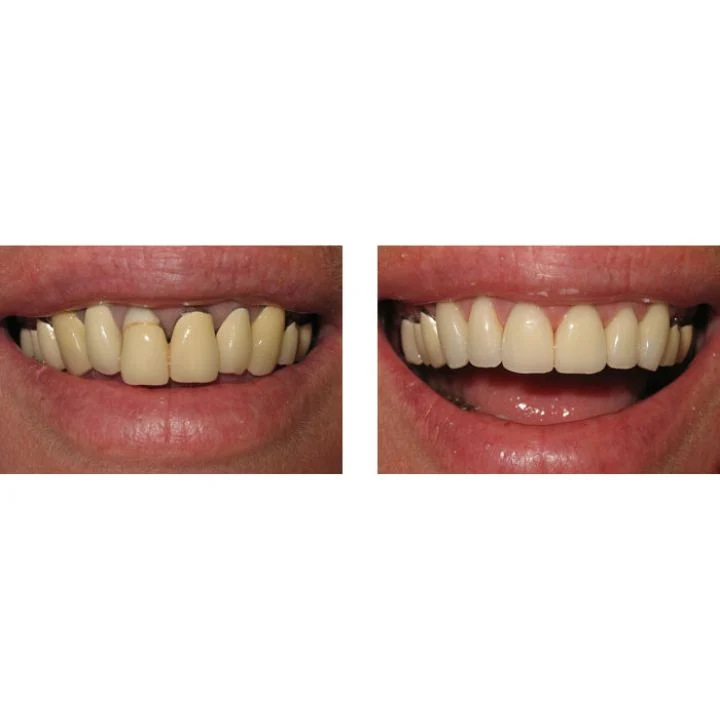 Washington State Prosthodontics