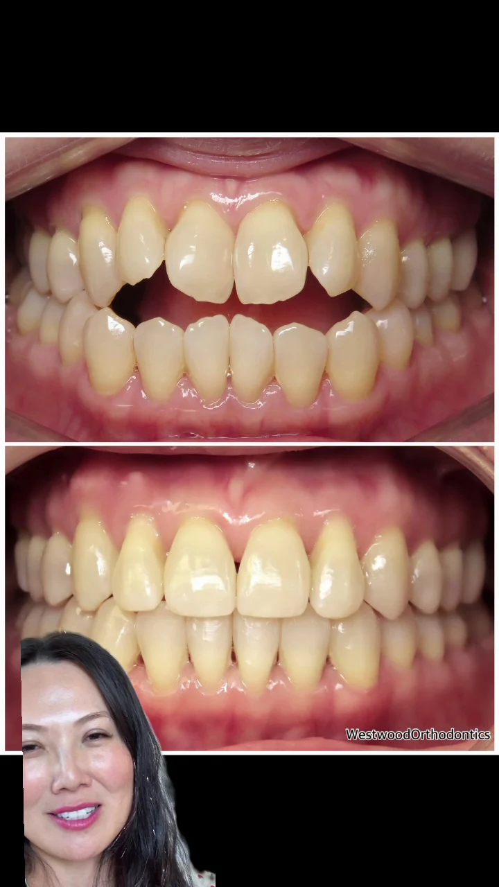 Westwood Orthodontics- Lisa Gao, DDS, MS - 3