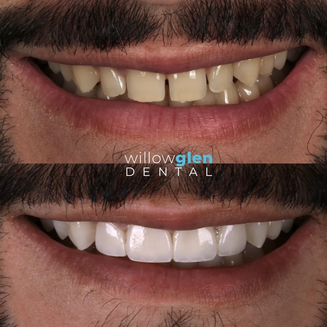 Willow Glen Dental - 3