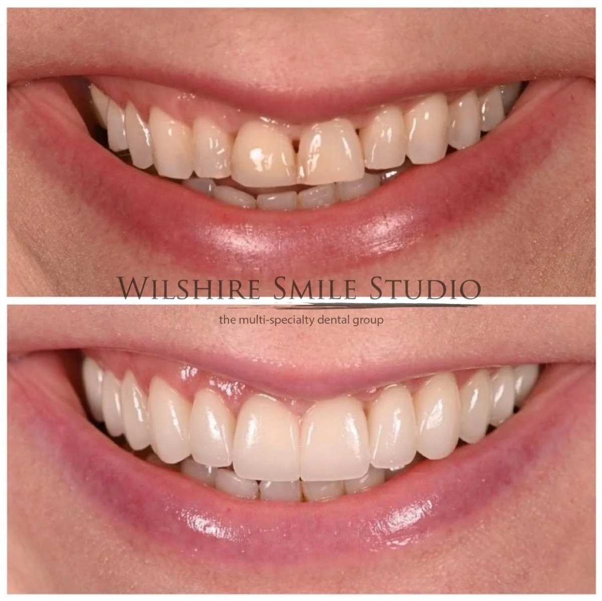 Wilshire Smile Studio - Los Angeles Dentist, Cosmetic and Emergency Dentistry - 4