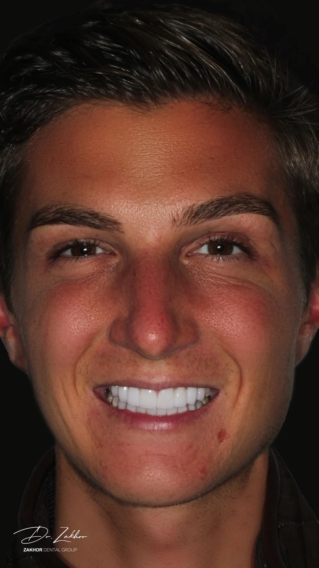 Zakhor Dental Group- Beverly Hills cosmetic dentist - 4